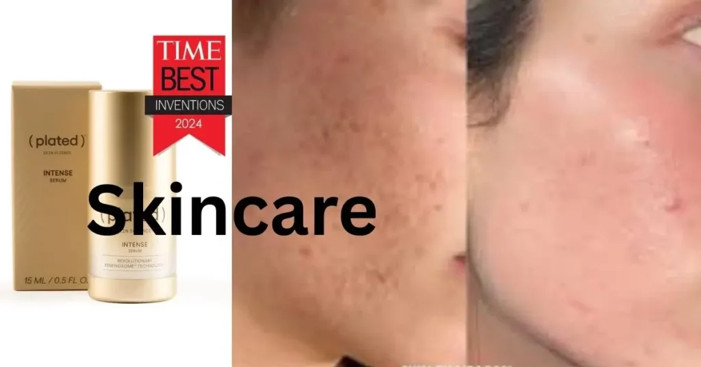 Plated skin science, Intense Serum bottle featuring TIME Best Inventions 2024 award, alongside before-and-after skin photos showing reduced redness and blemishes, with "Skincare" text overlay.