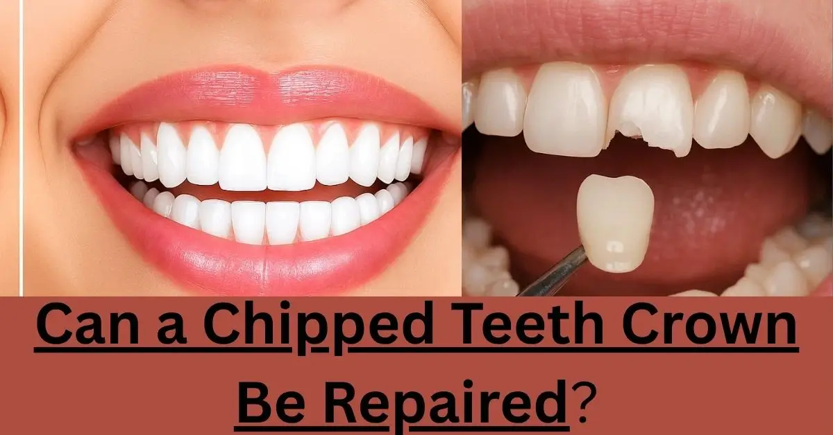 A split image showing a perfect smile and a chipped tooth, asking "Can a Chipped Teeth Crown Be Repaired?".